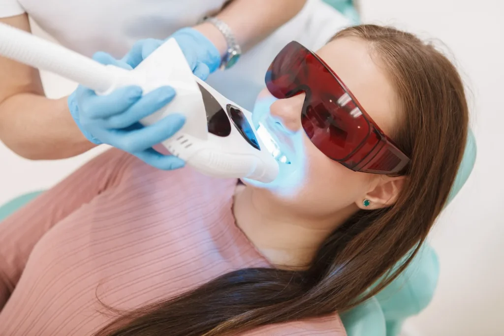 professional teeth whitening