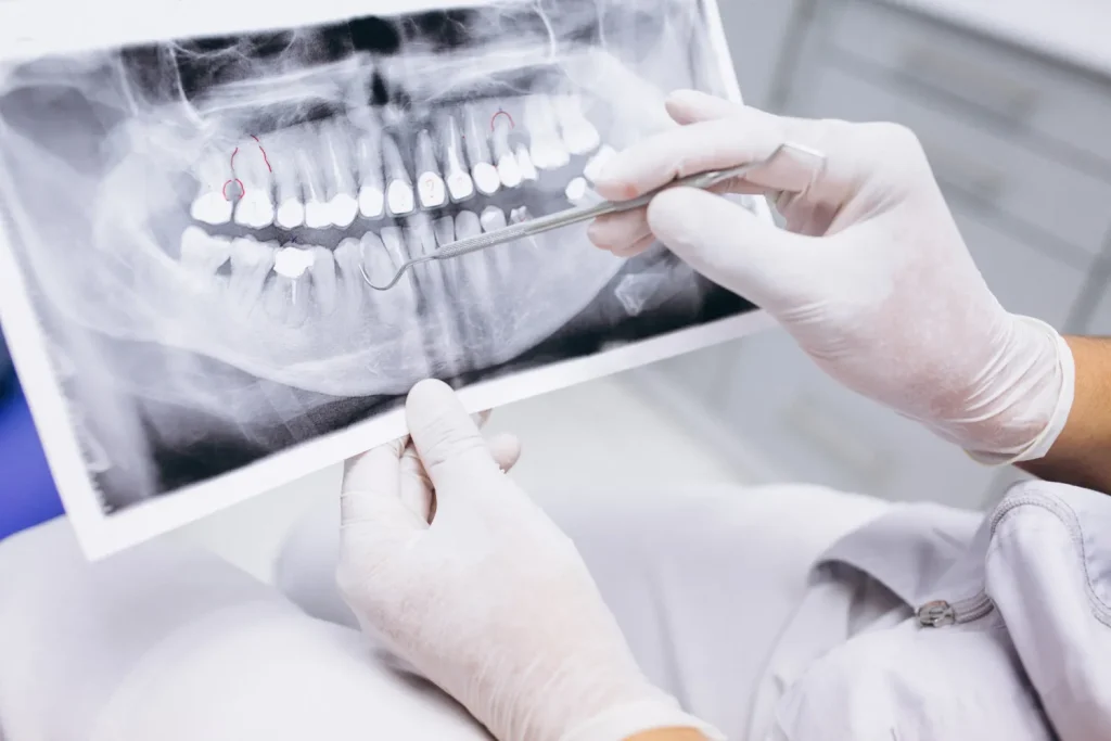 dental implant process