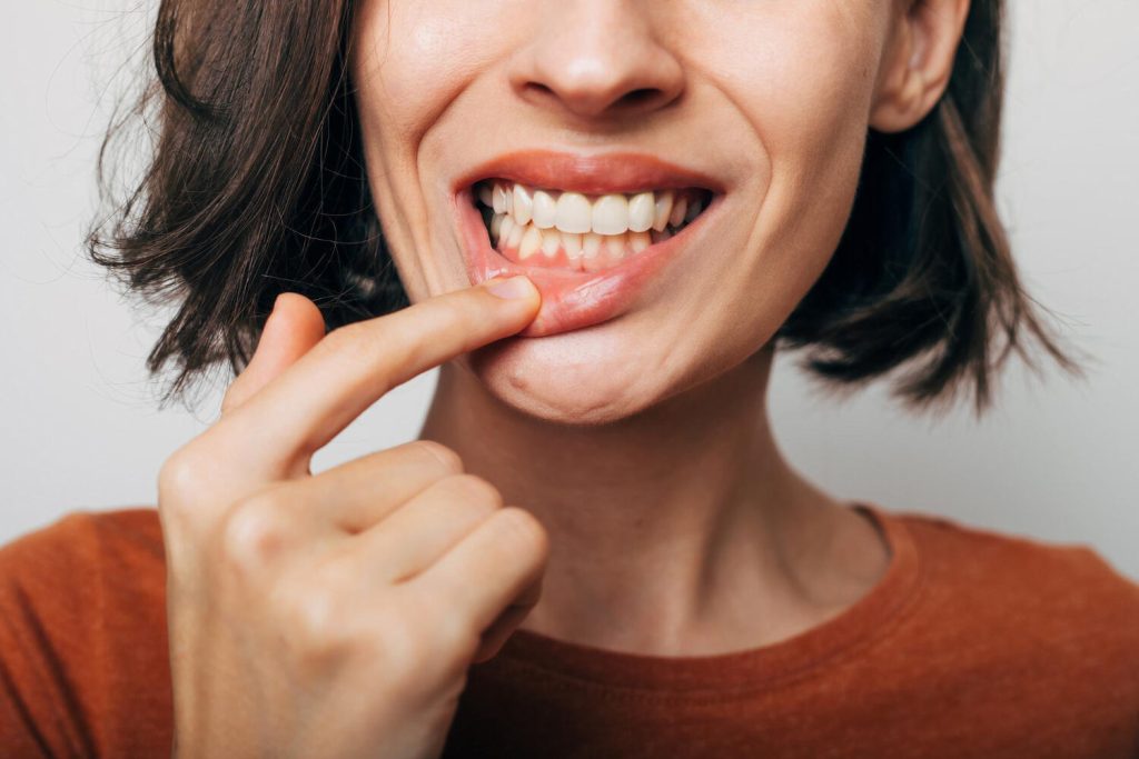 gum disease